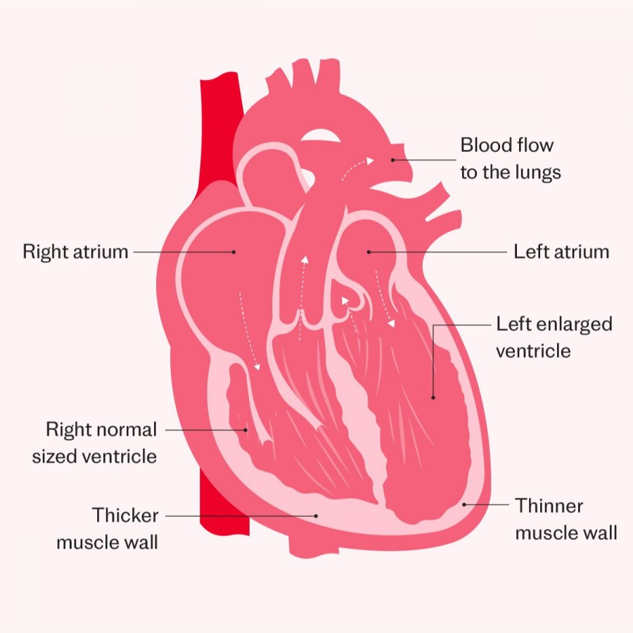 New pacemaker completely changes the functioning of a failing heart, Oxford scientists reveal